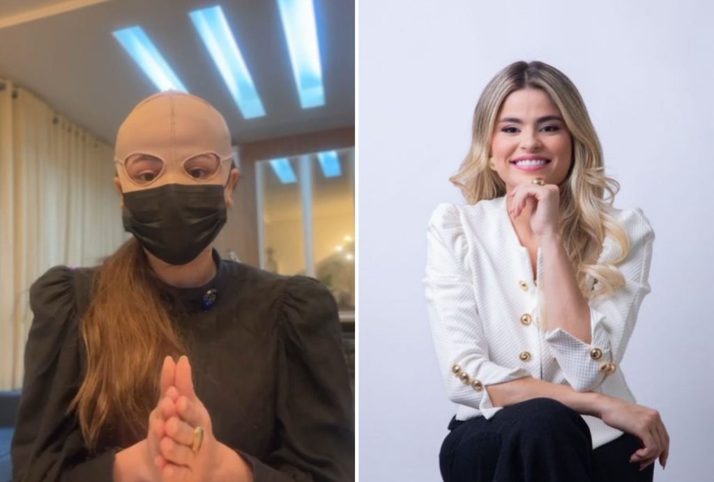 Médica pagou R$ 8 mil por peeling no rosto e diz que gastos com tratamento após queimaduras chegam a R$ 10 mil