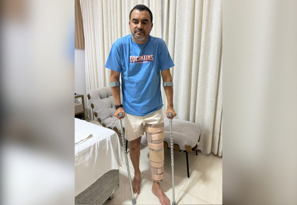 Governador Wanderlei Barbosa sofre lesão no joelho durante partida de futebol